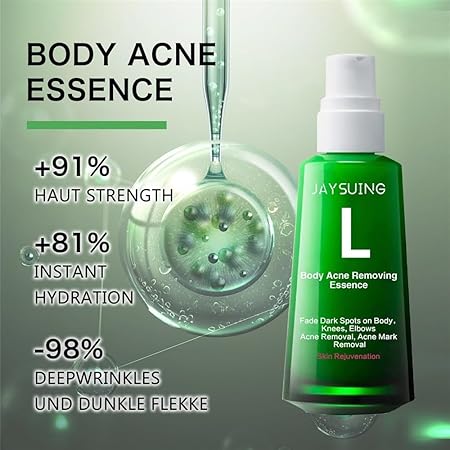 Body Pimple Repair Moisturizer (30ml) مرطب إصلاح البديل للجسم (30 مل