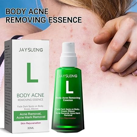 Body Pimple Repair Moisturizer (30ml) مرطب إصلاح البديل للجسم (30 مل